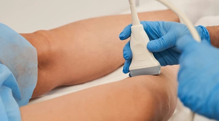 Ultrasonido Doppler vascular